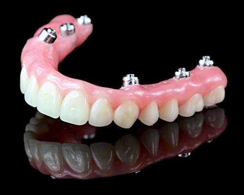 Wearing Dentures Kent OR 97033